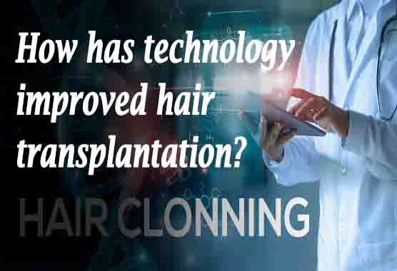 How has technology improved hair transplantation